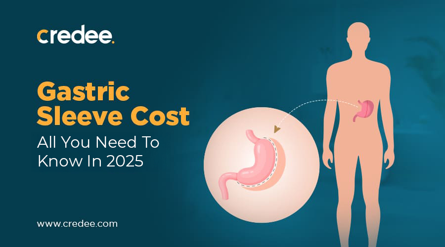 Gastric Sleeve Cost In 2025