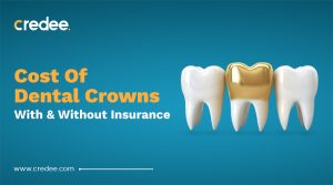 How Much Is A Dental Crowns Without Insurance? ( In 2025 )