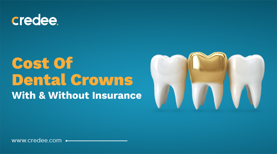 Cost Of Dental Crowns With & Without Insurance
