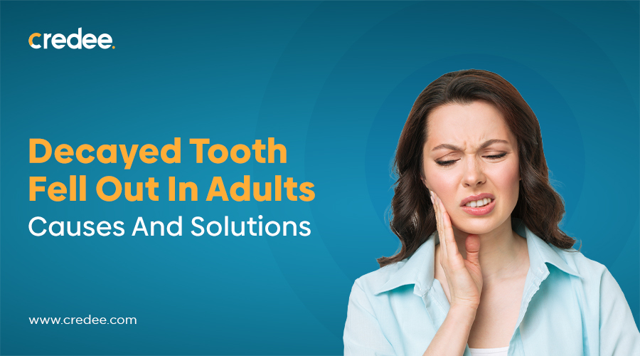 Causes And Solutions For Adult Tooth Loss Due To Decay