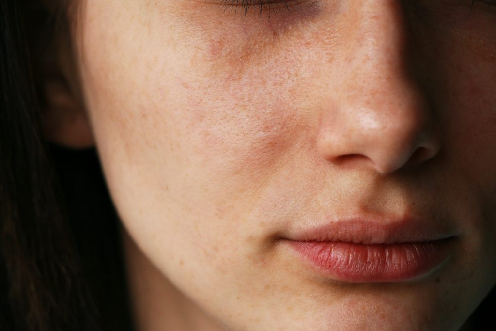 Bulbous Nose